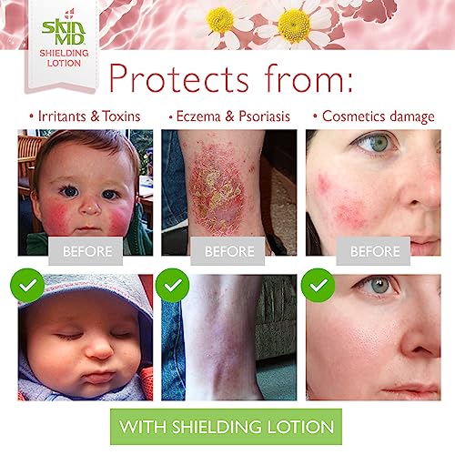 Skin MD Shielding Lotion 4oz. - hydrating, non-greasy, relief & serious protection for sensitive skin